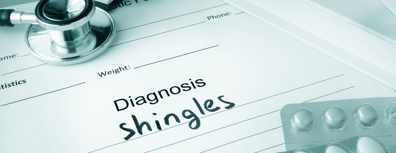 What do you know about shingles?