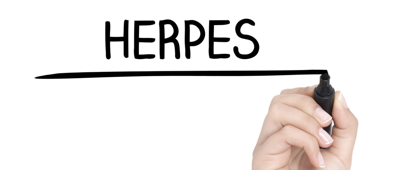Everything you need to know about genital herpes