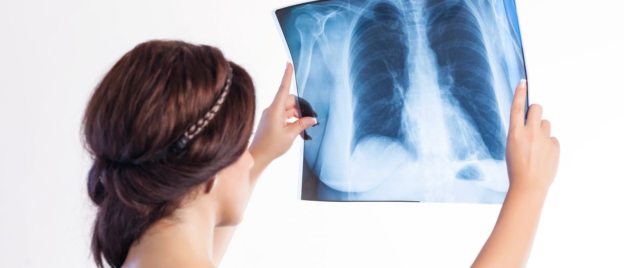 Coughing: How do you know if you have TB?