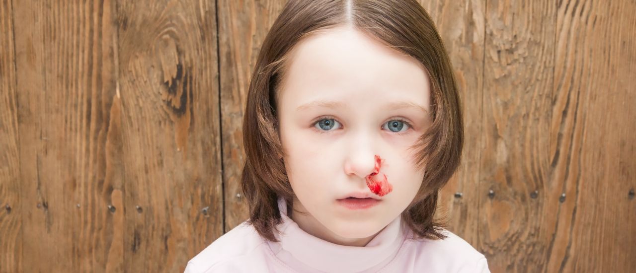How to treat your child’s nosebleed