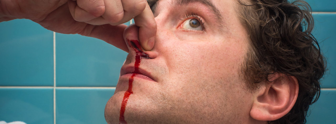 Nose bleeds – what you need to know