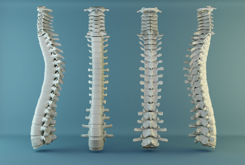 How to beat osteoporosis