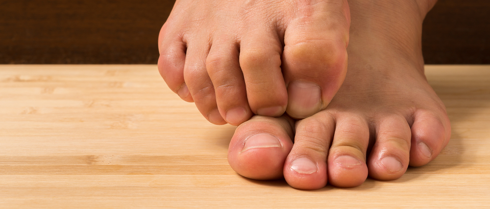 Eight ways to walk away from athlete’s foot