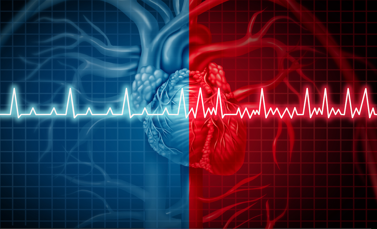 Heart palpitations : when should you worry?