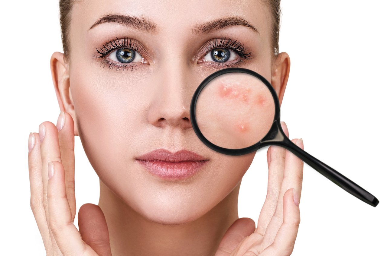 What your skin is telling you about your health